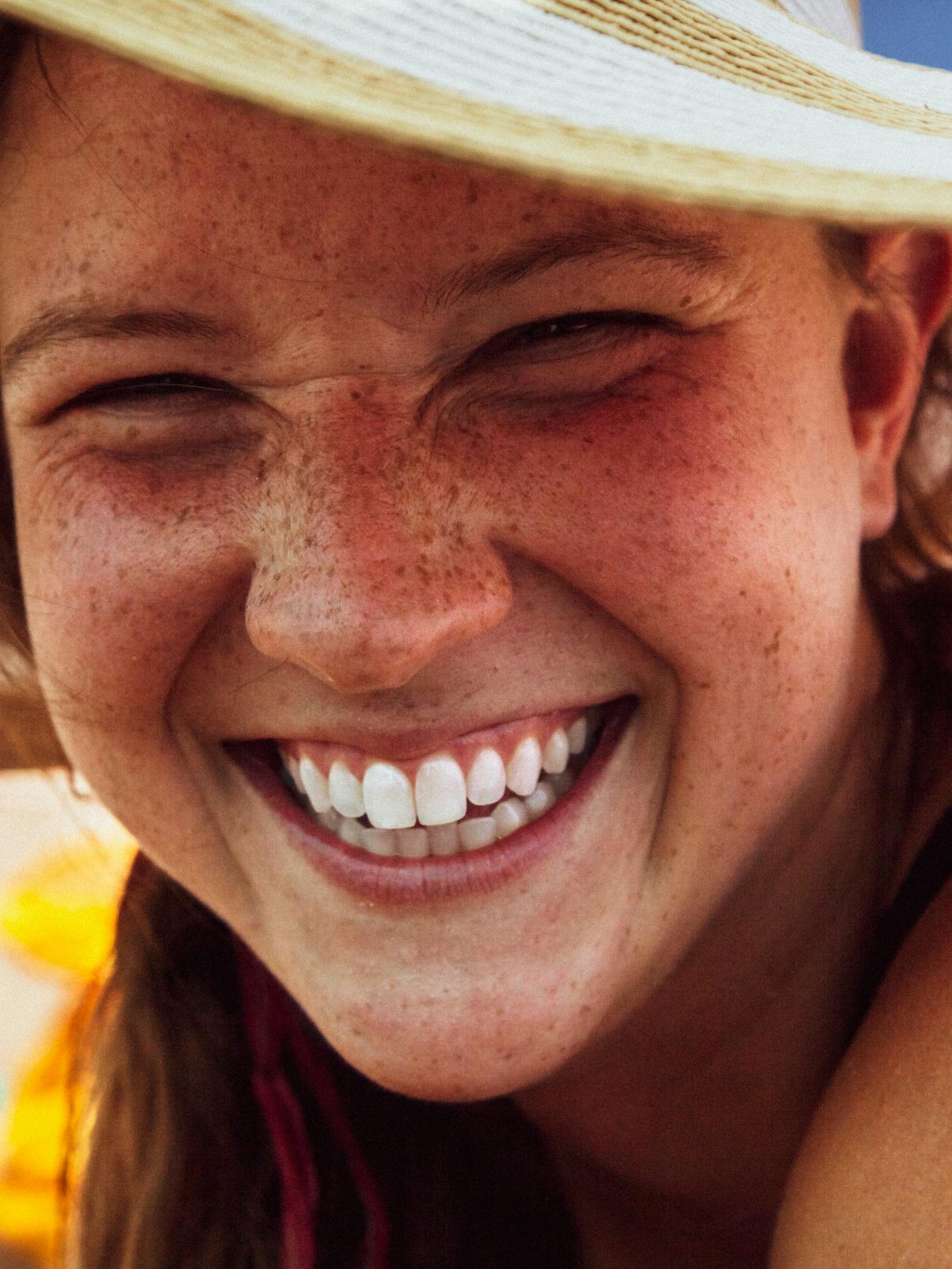 Woman wearing a sun hat smiling broadly outdoors, showing natural teeth and freckles
